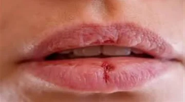 علامات الجلد المفتاحية التي تكشف اضطرابات صحية داخلية رئيسية 1